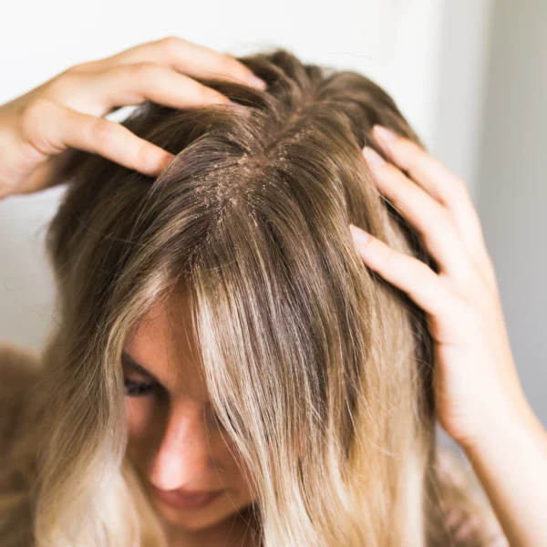 A woman with her hands on top of her head.